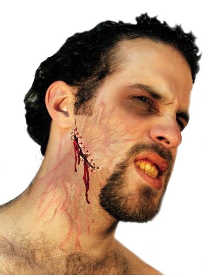 CICATRICE LATEX POINTS DE SUTURE 